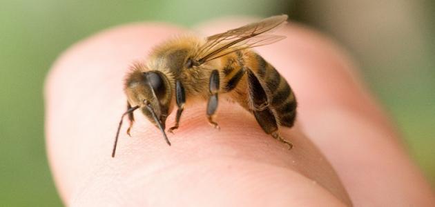 أعراض حساسية سم النحل