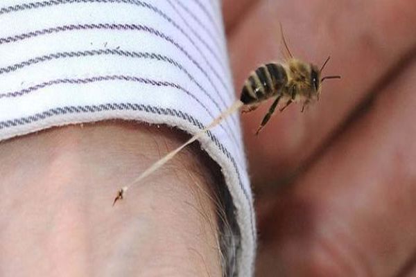 كيف تعالج قرصة النحل
