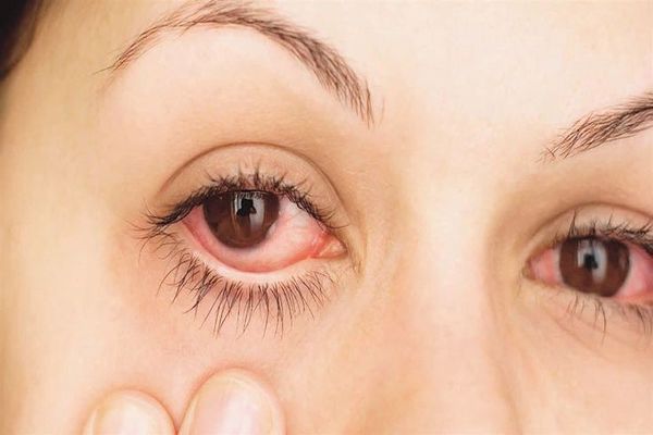 الأمراض التي تصيب العين وكيفية الوقاية منها