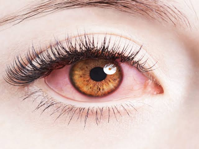 علاج التهاب شبكية العين بالأعشاب