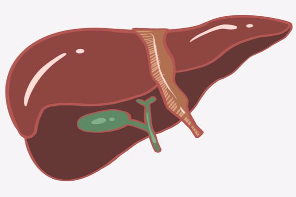 الفرق بين تليف الكبد وسرطان الكبد