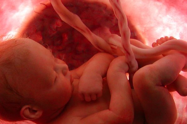 ما الفرق بين حمل خارج الرحم والحمل العنقودي